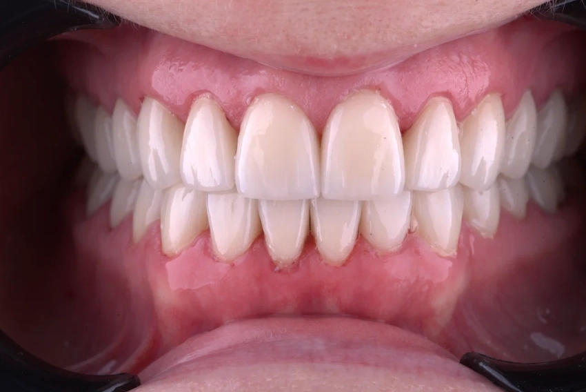 Лечить не зуб, а человека: почему современная стоматология переходит на общемедицинские рельсы